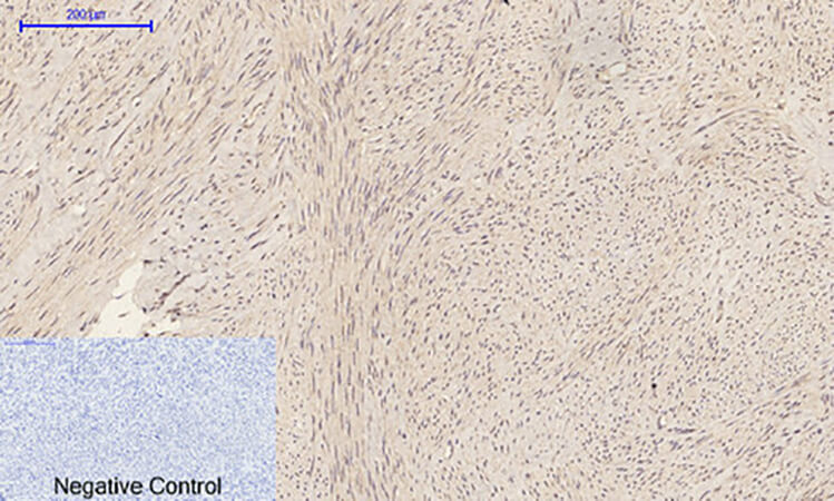 Fig.2. Immunohistochemical analysis of paraffin-embedded human uterus tissue. 1, Caspase-1 Polyclonal Antibody was diluted at 1:200 (4°C, overnight). 2, Sodium citrate pH 6.0 was used for antibody retrieval (>98°C, 20min). 3, secondary antibody was diluted at 1:200 (room temperature, 30min). Negative control was used by secondary antibody only.