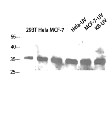 Fig.5. Western Blot analysis of 293T (1), Hela (2), MCF-7 (3), Hela-UV (4), MCF-7-UV (5), KB-UV (6), diluted at 1:1000.