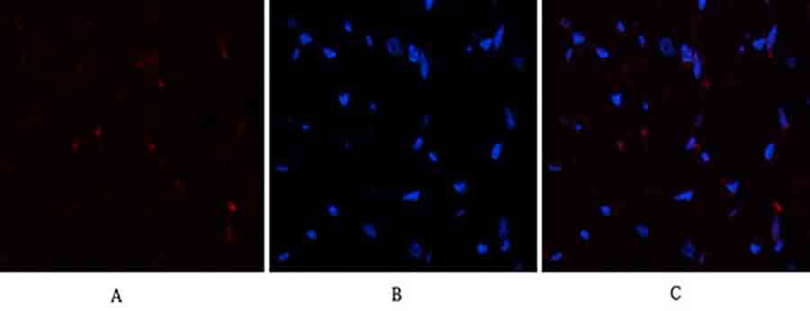 Fig.2. Immunofluorescence analysis of human-heart tissue. 1, PTEN Polyclonal Antibody (red) was diluted at 1:200 (4°C, overnight). 2, Cy3 Labeled secondary antibody was diluted at 1:300 (room temperature, 50min). 3, Picture B: DAPI (blue) 10min. Picture A: Target. Picture B: DAPI. Picture C: merge of A+B.