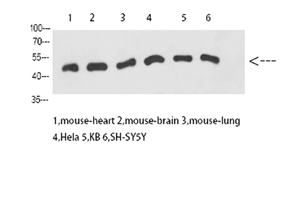 Fig.4. Western Blot analysis of mouse heart (1), mouse brain (2), mouse lung (3), Hela (4), KB (5), SH-SY5Y (6),  diluted at 1:1000.
