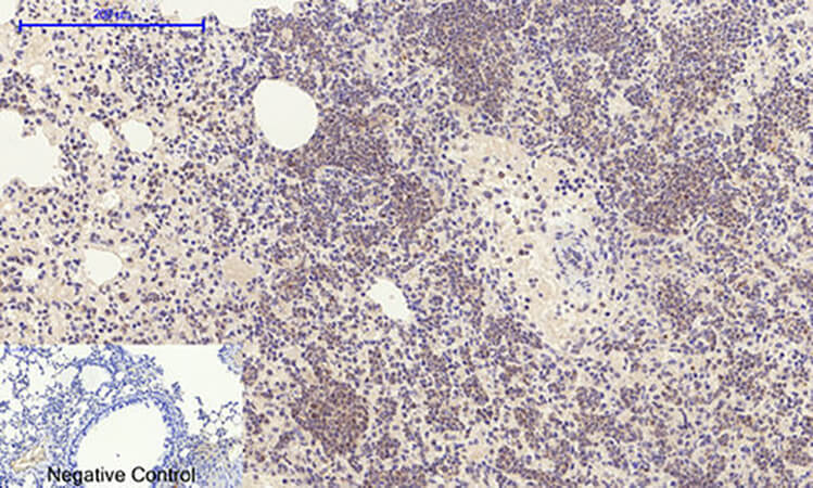 Fig.2. Immunohistochemical analysis of paraffin-embedded mouse lung tissue. 1, E2F-1 Polyclonal Antibody was diluted at 1:200 (4°C, overnight). 2, Sodium citrate pH 6.0 was used for antibody retrieval (>98°C, 20min). 3, secondary antibody was diluted at 1:200 (room temperature, 30min). Negative control was used by secondary antibody only.