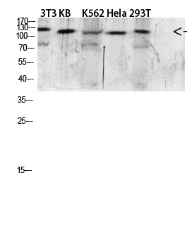 Fig.1. Western blot analysis of 293T Mouse-kidney lysate, antibody was diluted at 1:2000. HRP, Goat Anti-Rabbit IgG (Cat #: A21020) secondary antibody was diluted at 1:20000.