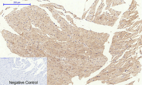 Fig.2. Immunohistochemical analysis of paraffin-embedded Rat-heart tissue. 1, Tau Polyclonal antibody was diluted at 1:200 (4°C,overnight). 2,  Sodium citrate pH 6.0 was used for antibody retrieval (>98°C,20min). 3,Secondary antibody was diluted at 1:200 (room tempeRature, 30min). Negative control was used by secondary antibody only.