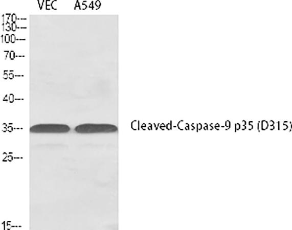 Fig.1. Western Blot analysis of VEC (1), A549 (2), diluted at 1:1000.
