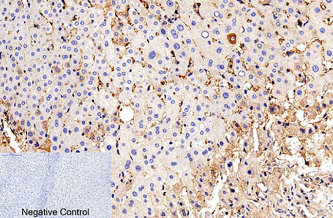 Fig.2. Immunohistochemical analysis of paraffin-embedded human liver tissue. 1, Cleaved-Caspase-9 p35 (D315) Polyclonal Antibody was diluted at 1:200 (4°C, overnight). 2, Sodium citrate pH 6.0 was used for antibody retrieval (>98°C, 20min). 3, secondary antibody was diluted at 1:200 (room temperature, 30min). Negative control was used by secondary antibody only.