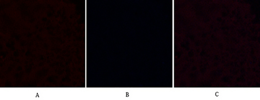 Fig.3. Immunofluorescence analysis of human breast tissue. 1, Cleaved-Caspase-9 p35 (D315) Polyclonal Antibody (red) was diluted at 1:200 (4°C, overnight). 2, Cy3 Labeled secondary antibody was diluted at 1:300 (room temperature, 50min). 3, Picture B: DAPI (blue) 10min. Picture A: Target. Picture B: DAPI. Picture C: merge of A+B.