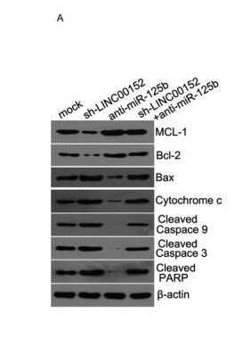 Fig.5. Downregulation of LINC00152 decreased the expression of MCL-1 and Bcl2, while increasing the expression of Bax, cytochrome c, cleaved caspase9, cleaved caspase 3, and cleaved PARP compared with the mock control.