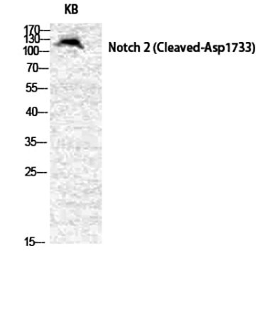 Fig.1. Western Blot analysis of various cells using Cleaved-Notch 2 (D1733) Polyclonal Antibody diluted at 1:500.