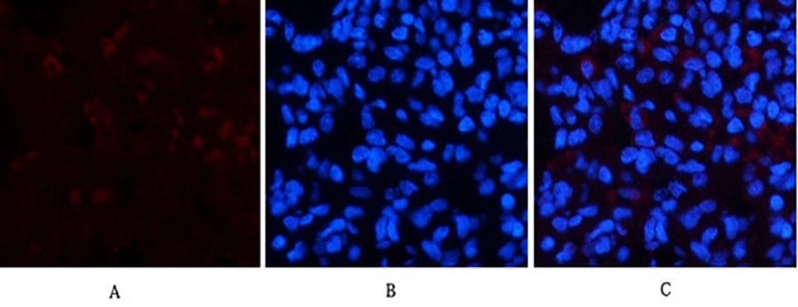 Fig.2. Immunofluorescence analysis of rat lung tissue. 1, Cleaved-Notch 2 (D1733) Polyclonal Antibody (red) was diluted at 1:200 (4°C, overnight). 2, Cy3 Labeled secondary antibody was diluted at 1:300 (room temperature, 50min). 3, Picture B: DAPI (blue) 10min. Picture A: Target. Picture B: DAPI. Picture C: merge of A+B.