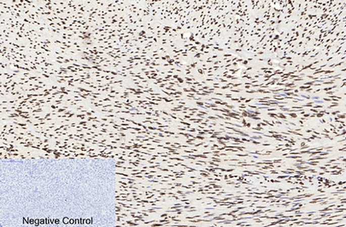 Fig.2. Immunohistochemical analysis of paraffin-embedded human uterus tissue. 1, Histone H3 (Acetyl Lys9) Polyclonal Antibody was diluted at 1:200 (4°C, overnight). 2, Sodium citrate pH 6.0 was used for antibody retrieval (>98°C, 20min). 3, secondary antibody was diluted at 1:200 (room temperature, 30min). Negative control was used by secondary antibody only.
