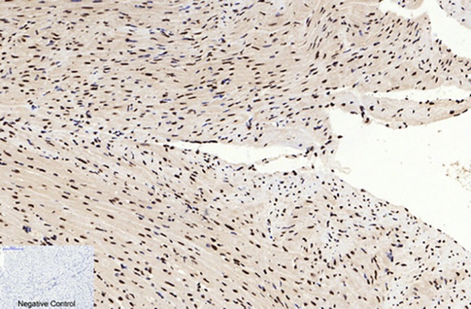 Fig.3. Immunohistochemical analysis of paraffin-embedded mouse heart tissue. 1, Histone H3 (Acetyl Lys9) Polyclonal Antibody was diluted at 1:200 (4°C, overnight). 2, Sodium citrate pH 6.0 was used for antibody retrieval (>98°C, 20min). 3, secondary antibody was diluted at 1:200 (room temperature, 30min). Negative control was used by secondary antibody only.