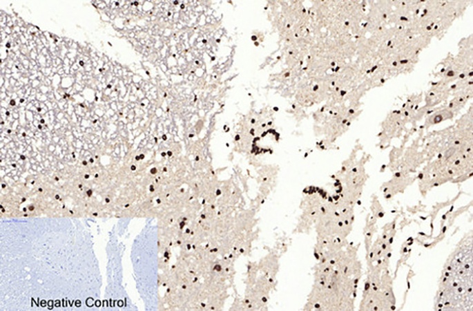 Fig.4. Immunohistochemical analysis of paraffin-embedded rat spinal cord tissue. 1, Histone H3 (Acetyl Lys9) Polyclonal Antibody was diluted at 1:200 (4°C, overnight). 2, Sodium citrate pH 6.0 was used for antibody retrieval (>98°C, 20min). 3, secondary antibody was diluted at 1:200 (room temperature, 30min). Negative control was used by secondary antibody only.