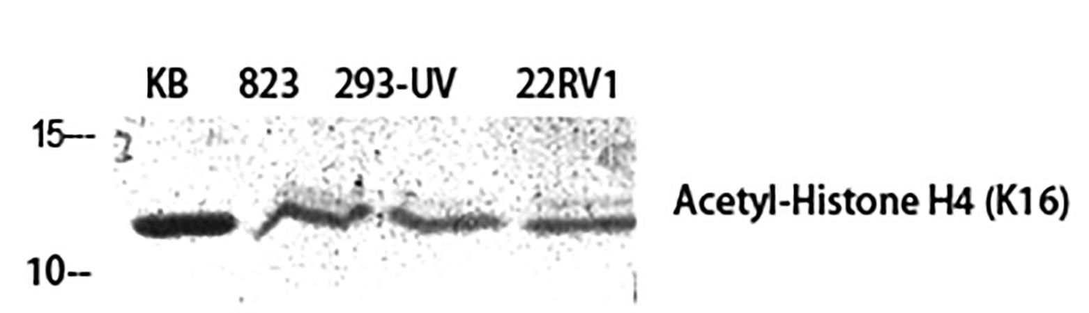 Fig.1. Western Blot analysis of KB (1), 823 (2), 293-UV (3), 22RV1 (4).
