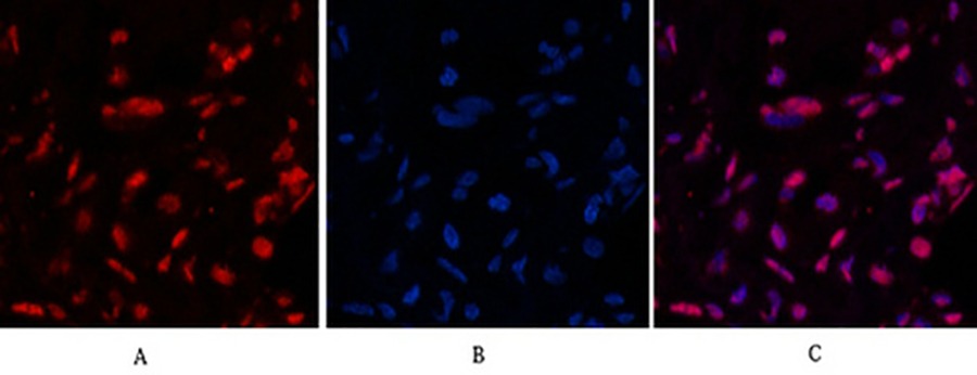 Fig.3. Immunofluorescence analysis of human lung tissue. 1, Histone H4 (Acetyl Lys16) Polyclonal Antibody (red) was diluted at 1:200 (4°C, overnight). 2, Cy3 Labeled secondary antibody was diluted at 1:300 (room temperature, 50min). 3, Picture B: DAPI (blue) 10min. Picture A: Target. Picture B: DAPI. Picture C: merge of A+B.
