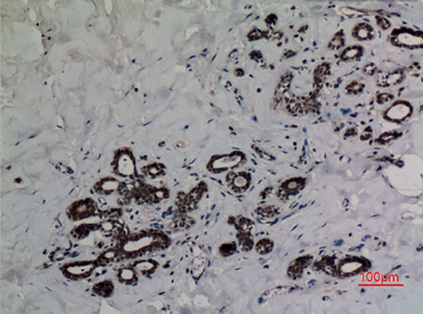 Fig.2. Immunohistochemical analysis of paraffin-embedded human breast, antibody was diluted at 1:100.