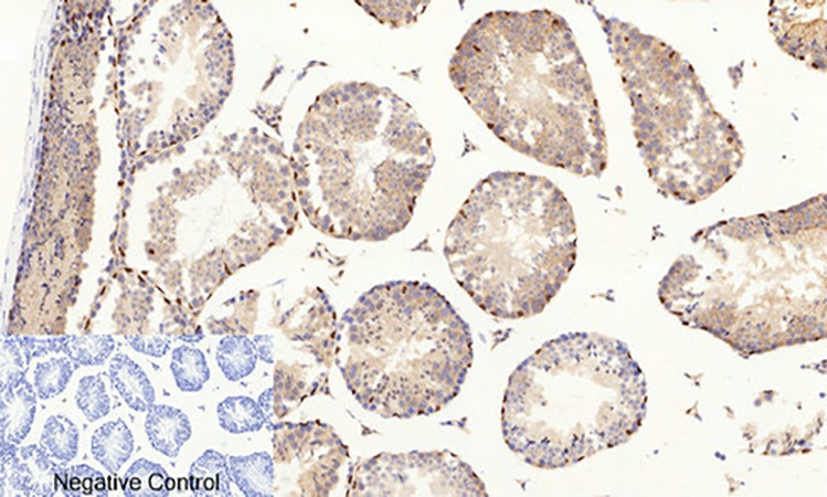 Fig.2. Immunohistochemical analysis of paraffin-embedded mouse testis tissue. 1, AP-1 (phospho Ser63) Polyclonal Antibody was diluted at 1:200 (4°C, overnight). 2, Sodium citrate pH 6.0 was used for antibody retrieval (>98°C, 20min). 3, secondary antibody was diluted at 1:200 (room temperature, 30min). Negative control was used by secondary antibody only.