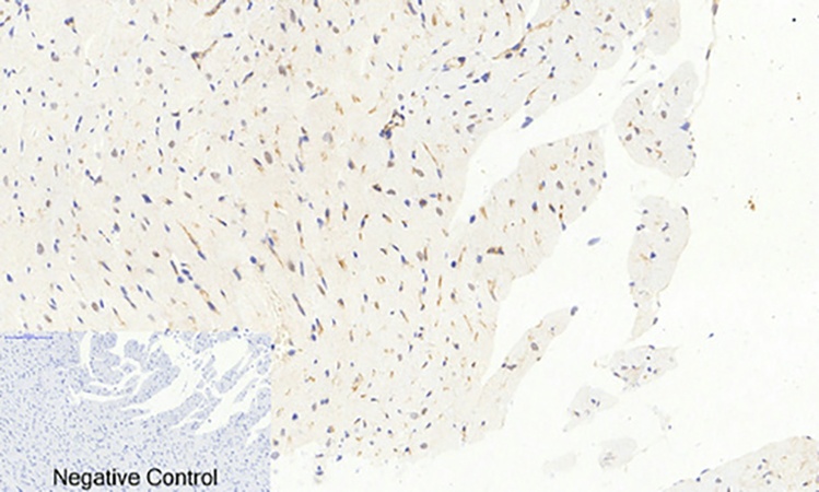 Fig.3. Immunohistochemical analysis of paraffin-embedded rat heart tissue. 1, AP-1 (phospho Ser63) Polyclonal Antibody was diluted at 1:200 (4°C, overnight). 2, Sodium citrate pH 6.0 was used for antibody retrieval (>98°C, 20min). 3, secondary antibody was diluted at 1:200 (room temperature, 30min). Negative control was used by secondary antibody only.