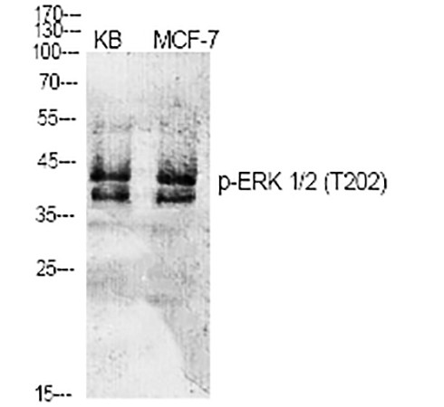 Fig.1. Western Blot analysis of various cells using Phospho-ERK 1/2 (T202) Polyclonal Antibody diluted at 1:1000.