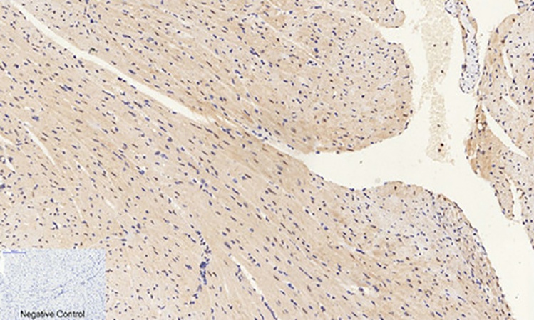 Fig.3. Immunohistochemical analysis of paraffin-embedded mouse heart tissue. 1, ERK 1/2 (phospho Thr202) Polyclonal Antibody was diluted at 1:200 (4°C, overnight). 2, Sodium citrate pH 6.0 was used for antibody retrieval (>98°C, 20min). 3, secondary antibody was diluted at 1:200 (room temperature, 30min). Negative control was used by secondary antibody only.