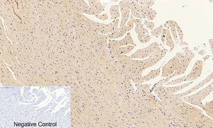 Fig.4. Immunohistochemical analysis of paraffin-embedded rat heart tissue. 1, ERK 1/2 (phospho Thr202) Polyclonal Antibody was diluted at 1:200 (4°C, overnight). 2, Sodium citrate pH 6.0 was used for antibody retrieval (>98°C, 20min). 3, secondary antibody was diluted at 1:200 (room temperature, 30min). Negative control was used by secondary antibody only.