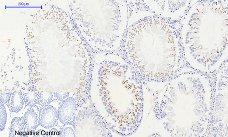 Fig.4. Immunohistochemical analysis of paraffin-embedded rat testis tissue. 1, Histone H2A.X (phospho Ser139) Polyclonal Antibody was diluted at 1:200 (4°C, overnight). 2, Sodium citrate pH 6.0 was used for antibody retrieval (>98°C, 20min). 3, secondary antibody was diluted at 1:200 (room temperature, 30min). Negative control was used by secondary antibody only.