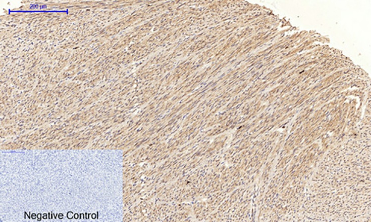 Fig.2. Immunohistochemical analysis of paraffin-embedded human uterus tissue. 1, JNK1/2/3 (phospho Thr183/Y185) Polyclonal Antibody was diluted at 1:200 (4°C, overnight). 2, Sodium citrate pH 6.0 was used for antibody retrieval (>98°C, 20min). 3, secondary antibody was diluted at 1:200 (room temperature, 30min). Negative control was used by secondary antibody only.