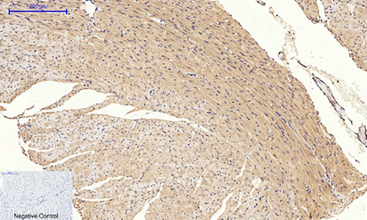 Fig.3. Immunohistochemical analysis of paraffin-embedded mouse heart tissue. 1, JNK1/2/3 (phospho Thr183/Y185) Polyclonal Antibody was diluted at 1:200 (4°C, overnight). 2, Sodium citrate pH 6.0 was used for antibody retrieval (>98°C, 20min). 3, secondary antibody was diluted at 1:200 (room temperature, 30min). Negative control was used by secondary antibody only.