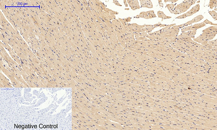 Fig.4. Immunohistochemical analysis of paraffin-embedded rat heart tissue. 1, JNK1/2/3 (phospho Thr183/Y185) Polyclonal Antibody was diluted at 1:200 (4°C, overnight). 2, Sodium citrate pH 6.0 was used for antibody retrieval (>98°C, 20min). 3, secondary antibody was diluted at 1:200 (room temperature, 30min). Negative control was used by secondary antibody only.