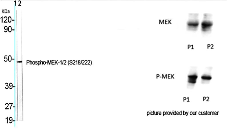 Fig.1. Western Blot analysis of various cells using Phospho-MEK-1/2 (S218/222) Polyclonal Antibody.