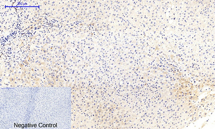Fig.2. Immunohistochemical analysis of paraffin-embedded human liver tissue. 1, MEK-1/2 (phospho Ser218/222) Polyclonal Antibody was diluted at 1:200 (4°C, overnight). 2, Sodium citrate pH 6.0 was used for antibody retrieval (>98°C, 20min). 3, secondary antibody was diluted at 1:200 (room temperature, 30min). Negative control was used by secondary antibody only.