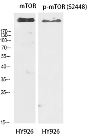 Fig.1. Western Blot analysis of mTOR (1), p-mTOR (S2448) (2), diluted at 1:1000.