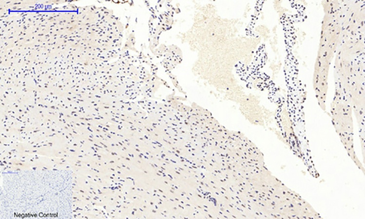 Fig.3. Immunohistochemical analysis of paraffin-embedded mouse heart tissue. 1, mTOR (phospho Ser2448) Polyclonal Antibody was diluted at 1:200 (4°C, overnight). 2, Sodium citrate pH 6.0 was used for antibody retrieval (>98°C, 20min). 3, secondary antibody was diluted at 1:200 (room temperature, 30min). Negative control was used by secondary antibody only.