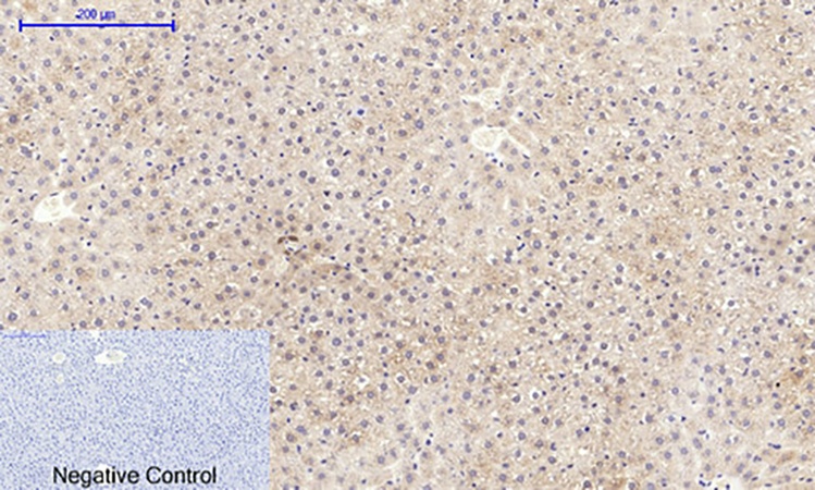 Fig.4. Immunohistochemical analysis of paraffin-embedded rat liver tissue. 1, mTOR (phospho Ser2448) Polyclonal Antibody was diluted at 1:200 (4°C, overnight). 2, Sodium citrate pH 6.0 was used for antibody retrieval (>98°C, 20min). 3, secondary antibody was diluted at 1:200 (room temperature, 30min). Negative control was used by secondary antibody only.