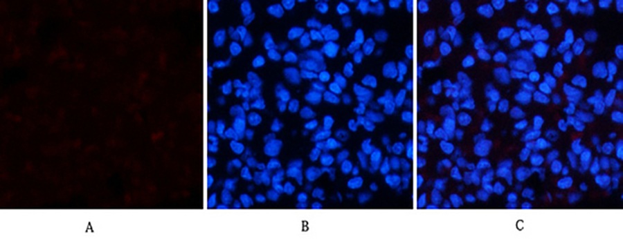 Fig.2. Immunofluorescence analysis of rat lung tissue. 1, p38 (phospho Thr180) Polyclonal Antibody (red) was diluted at 1:200 (4°C, overnight). 2, Cy3 Labeled secondary antibody was diluted at 1:300 (room temperature, 50min). 3, Picture B: DAPI (blue) 10min. Picture A: Target. Picture B: DAPI. Picture C: merge of A+B.