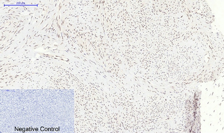 Fig.3. Immunohistochemical analysis of paraffin-embedded human uterus tissue. 1, p38 (phospho Thr180) Polyclonal Antibody was diluted at 1:200 (4°C, overnight). 2, Sodium citrate pH 6.0 was used for antibody retrieval (>98°C, 20min). 3, secondary antibody was diluted at 1:200 (room temperature, 30min). Negative control was used by secondary antibody only.