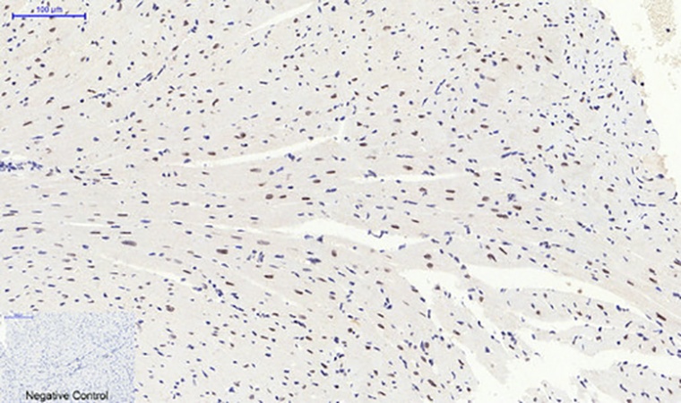 Fig.4. Immunohistochemical analysis of paraffin-embedded mouse heart tissue. 1, p38 (phospho Thr180) Polyclonal Antibody was diluted at 1:200 (4°C, overnight). 2, Sodium citrate pH 6.0 was used for antibody retrieval (>98°C, 20min). 3, secondary antibody was diluted at 1:200 (room temperature, 30min). Negative control was used by secondary antibody only.