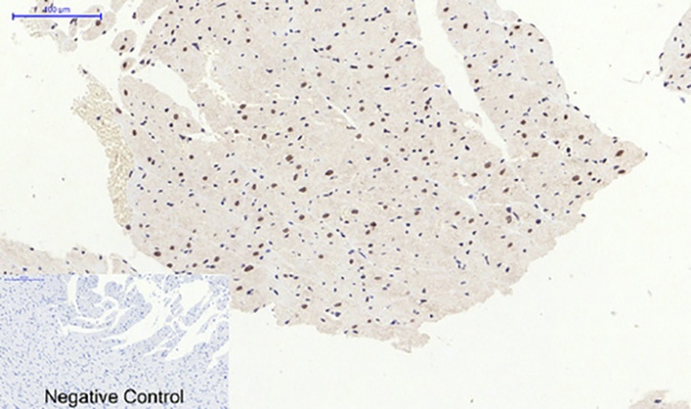 Fig.5. Immunohistochemical analysis of paraffin-embedded rat heart tissue. 1, p38 (phospho Thr180) Polyclonal Antibody was diluted at 1:200 (4°C, overnight). 2, Sodium citrate pH 6.0 was used for antibody retrieval (>98°C, 20min). 3, secondary antibody was diluted at 1:200 (room temperature, 30min). Negative control was used by secondary antibody only.