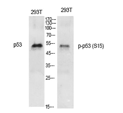 Fig.1. Western Blot analysis of various cells using Phospho-p53 (S15) Polyclonal Antibody diluted at 1:1000.