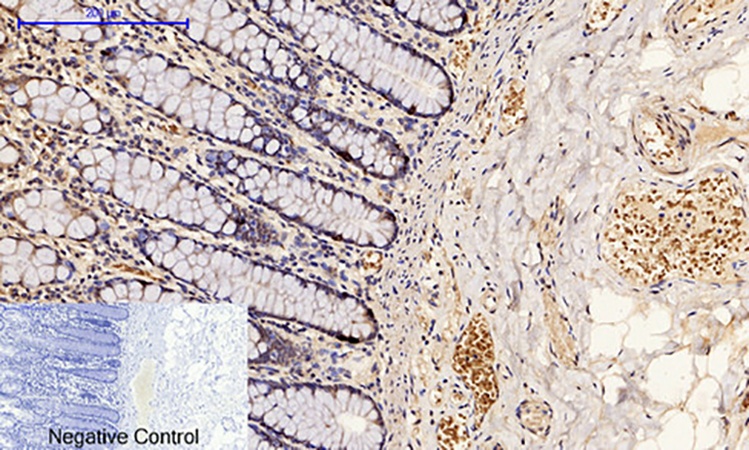 Fig.2. Immunohistochemical analysis of paraffin-embedded human colon tissue. 1, p53 (phospho Ser15) Polyclonal Antibody was diluted at 1:200 (4°C, overnight). 2, Sodium citrate pH 6.0 was used for antibody retrieval (>98°C, 20min). 3, secondary antibody was diluted at 1:200 (room temperature, 30min). Negative control was used by secondary antibody only.