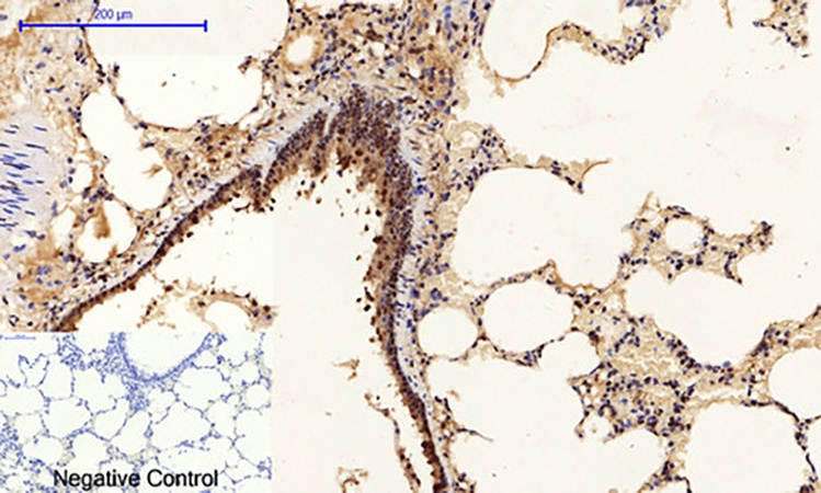 Fig.4. Immunohistochemical analysis of paraffin-embedded rat lung tissue. 1, p53 (phospho Ser15) Polyclonal Antibody was diluted at 1:200 (4°C, overnight). 2, Sodium citrate pH 6.0 was used for antibody retrieval (>98°C, 20min). 3, secondary antibody was diluted at 1:200 (room temperature, 30min). Negative control was used by secondary antibody only.
