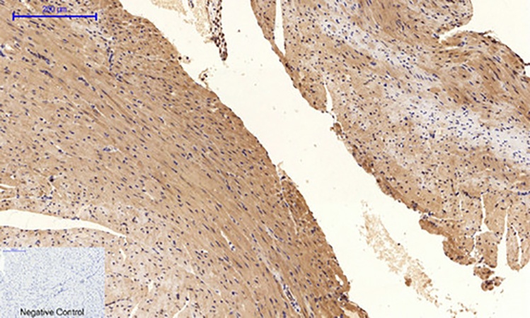 Fig.3. Immunohistochemical analysis of paraffin-embedded mouse heart tissue. 1, Tau (phospho Ser396) Polyclonal Antibody was diluted at 1:200 (4°C, overnight). 2, Sodium citrate pH 6.0 was used for antibody retrieval (>98°C, 20min). 3, secondary antibody was diluted at 1:200 (room temperature, 30min). Negative control was used by secondary antibody only.