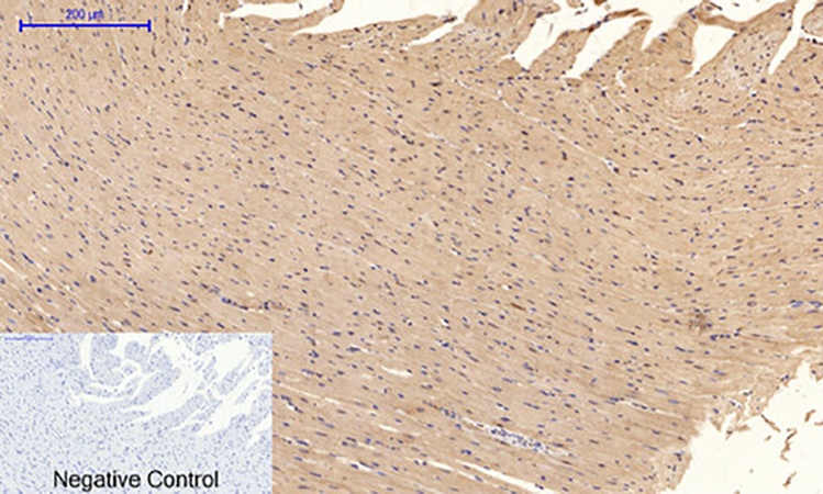 Fig.4. Immunohistochemical analysis of paraffin-embedded rat heart tissue. 1, Tau (phospho Ser396) Polyclonal Antibody was diluted at 1:200 (4°C, overnight). 2, Sodium citrate pH 6.0 was used for antibody retrieval (>98°C, 20min). 3, secondary antibody was diluted at 1:200 (room temperature, 30min). Negative control was used by secondary antibody only.