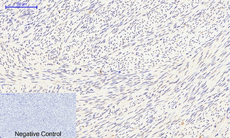 Fig.2. Immunohistochemical analysis of paraffin-embedded human uterus tissue. 1, Smad3 (phospho Ser425) Polyclonal Antibody was diluted at 1:200 (4°C, overnight). 2, Sodium citrate pH 6.0 was used for antibody retrieval (>98°C, 20min). 3, secondary antibody was diluted at 1:200 (room temperature, 30min). Negative control was used by secondary antibody only.