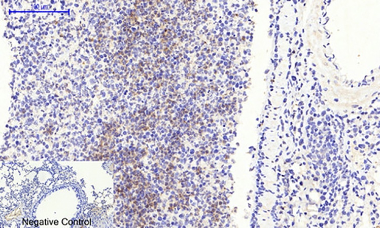 Fig.3. Immunohistochemical analysis of paraffin-embedded mouse lung tissue. 1, Smad3 (phospho Ser425) Polyclonal Antibody was diluted at 1:200 (4°C, overnight). 2, Sodium citrate pH 6.0 was used for antibody retrieval (>98°C, 20min). 3, secondary antibody was diluted at 1:200 (room temperature, 30min). Negative control was used by secondary antibody only.