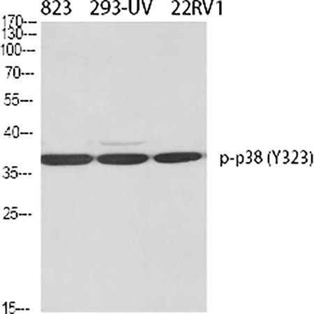 Fig.1. Western Blot analysis of 823(1), 293-UV(2), 22RV1(3), diluted at 1:500.