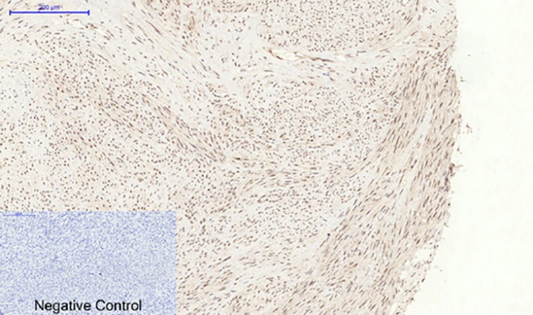 Fig.3. Immunohistochemical analysis of paraffin-embedded human uterus tissue. 1, p38 (phospho Tyr323) Polyclonal Antibody was diluted at 1:200 (4°C, overnight). 2, Sodium citrate pH 6.0 was used for antibody retrieval (>98°C, 20min). 3, secondary antibody was diluted at 1:200 (room temperature, 30min). Negative control was used by secondary antibody only.