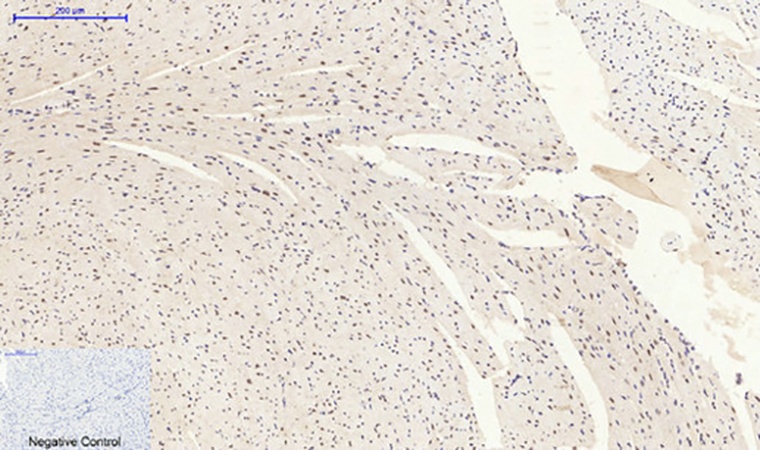 Fig.4. Immunohistochemical analysis of paraffin-embedded mouse heart tissue. 1, p38 (phospho Tyr323) Polyclonal Antibody was diluted at 1:200 (4°C, overnight). 2, Sodium citrate pH 6.0 was used for antibody retrieval (>98°C, 20min). 3, secondary antibody was diluted at 1:200 (room temperature, 30min). Negative control was used by secondary antibody only.