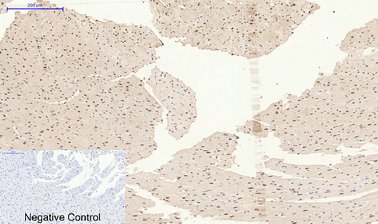 Fig.5. Immunohistochemical analysis of paraffin-embedded rat heart tissue. 1, p38 (phospho Tyr323) Polyclonal Antibody was diluted at 1:200 (4°C, overnight). 2, Sodium citrate pH 6.0 was used for antibody retrieval (>98°C, 20min). 3, secondary antibody was diluted at 1:200 (room temperature, 30min). Negative control was used by secondary antibody only.