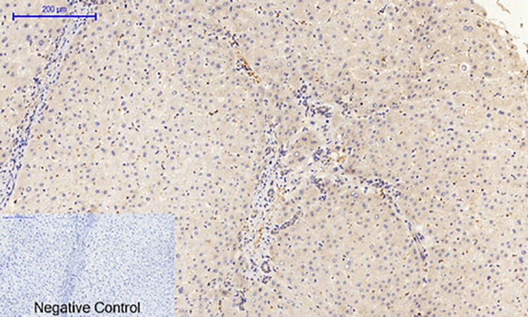 Fig.2. Immunohistochemical analysis of paraffin-embedded human liver tissue. 1, FAK (phospho Tyr397) Polyclonal Antibody was diluted at 1:200 (4°C, overnight). 2, Sodium citrate pH 6.0 was used for antibody retrieval (>98°C, 20min). 3, secondary antibody was diluted at 1:200 (room temperature, 30min). Negative control was used by secondary antibody only.