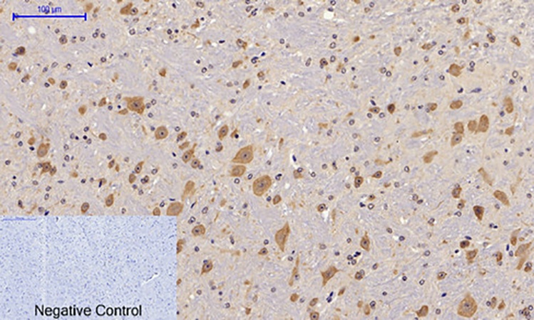Fig.3. Immunohistochemical analysis of paraffin-embedded mouse brain tissue. 1, FAK (phospho Tyr397) Polyclonal Antibody was diluted at 1:200 (4°C, overnight). 2, Sodium citrate pH 6.0 was used for antibody retrieval (>98°C, 20min) . 3, secondary antibody was diluted at 1:200 (room temperature, 30min). Negative control was used by secondary antibody only.